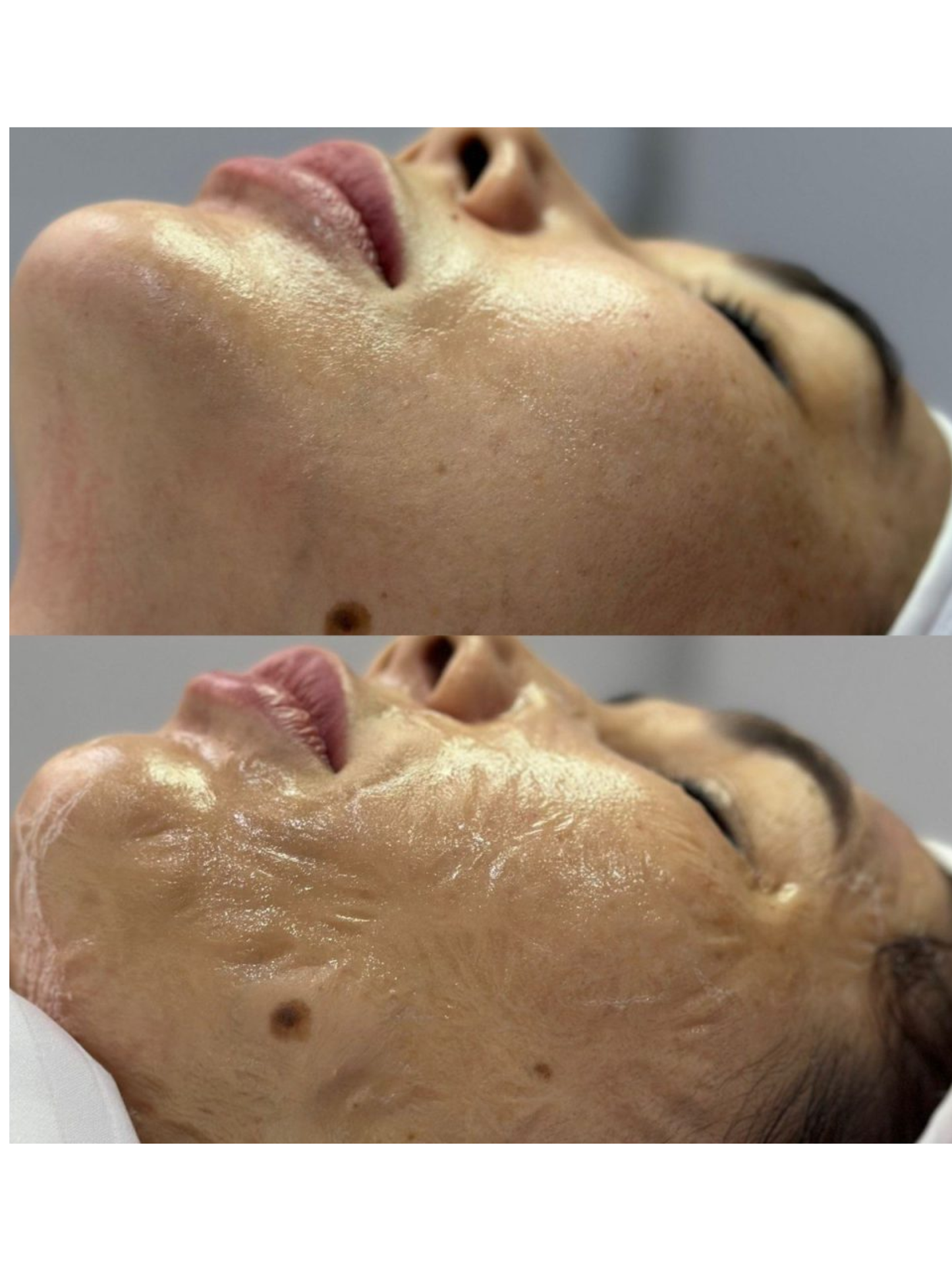 JeuDerm - Lift Intense Viso Contour 110 ml, EXP: 05/2028